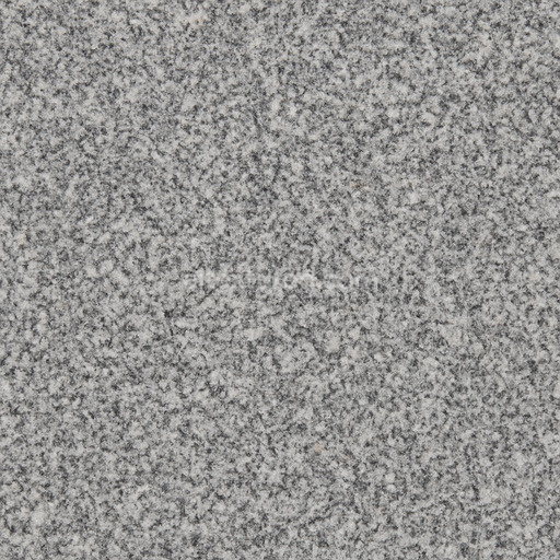 Fine Granite Seamless Texture