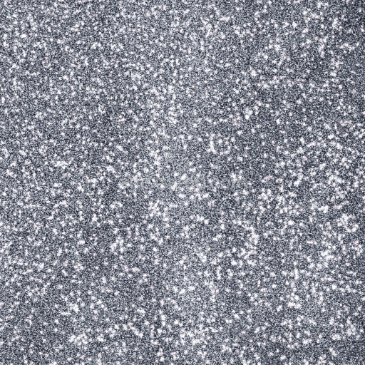 Seamless 3D PBR Silver Glitter Texture with Dense Sparkle Pattern