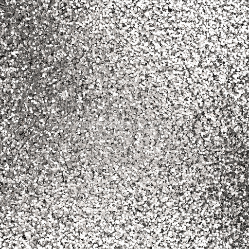 Seamless 3D PBR Texture of Dense Silver Glitter Sparkles