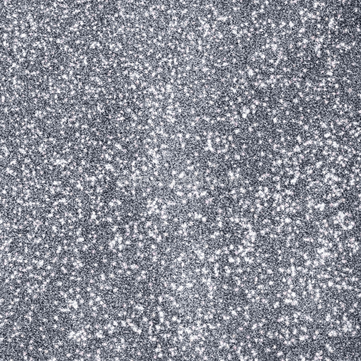 Seamless 3D PBR Texture of Sparkling Silver Glitter Particles